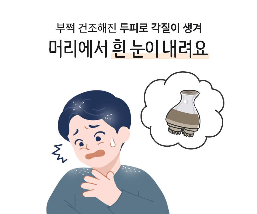 부쩍 건조해진 두피로 각질이 생겨 머리에서 흰 눈이 내려요